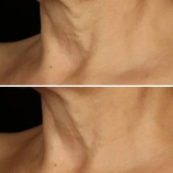 Smart Clinical Repair™ Lifting Face + Neck Cream liftingujący krem do twarzy i szyi 50ml